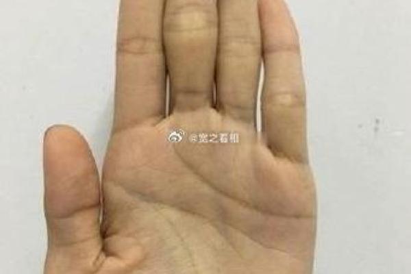揭秘：手相中指根部肉鼓起的秘密，竟隐藏这惊人运势