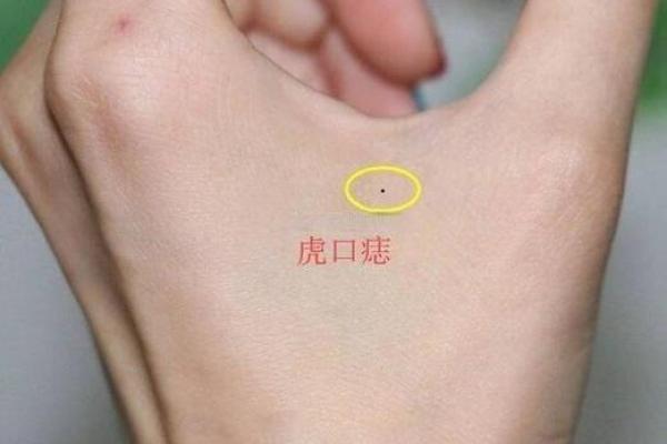 手心痣相大全：解读命运的秘密印记