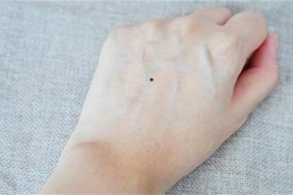 痣相与手相背道而驰，揭秘人生路上的神秘指引