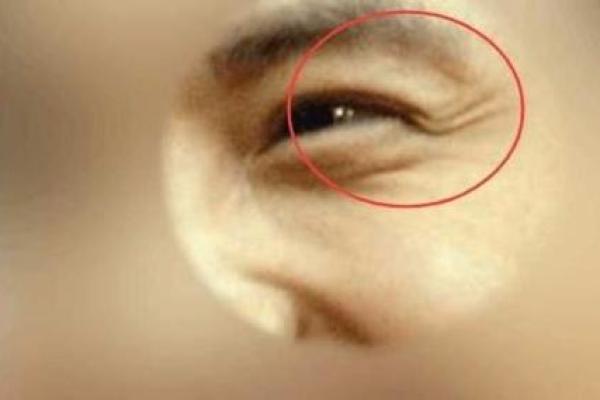 鱼尾纹暴露年龄？揭秘面相中的鱼尾纹秘密