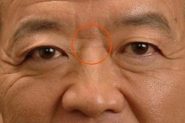 如何解读男人印堂八字纹，命运的关键所在