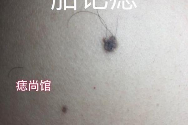 一颗痣定终身，他的人生轨迹大揭秘