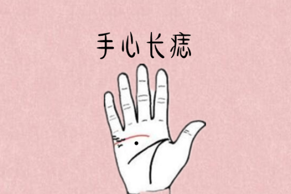 龙痣显贵：探寻这颗痣背后的非凡人生轨迹