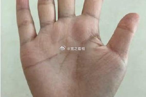 手相揭秘：感情线锁链纹，预示着怎样的命运转折？