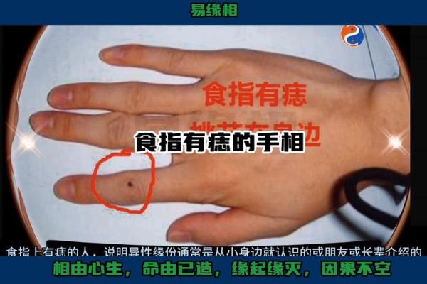 手相揭秘：指头肚长痦子暗示什么运势？必看