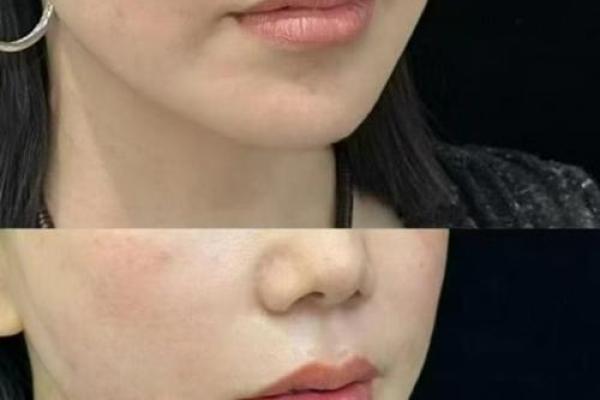 嘴角笑纹：揭示幸福人生的秘密面相密码