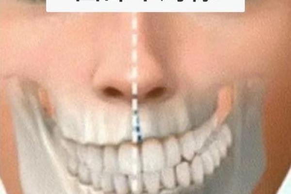 面相学中的嘴歪：从外貌看内在健康