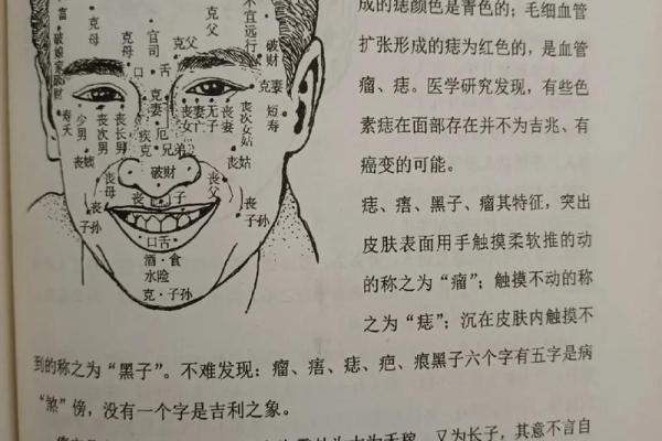 痣的独特印记：这位男生脸上的痣让人过目难忘
