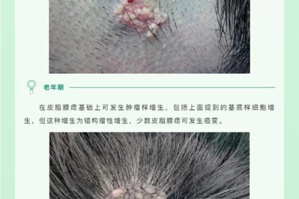 痣痣长毛，健康财富双丰收一探究竟的神奇现象