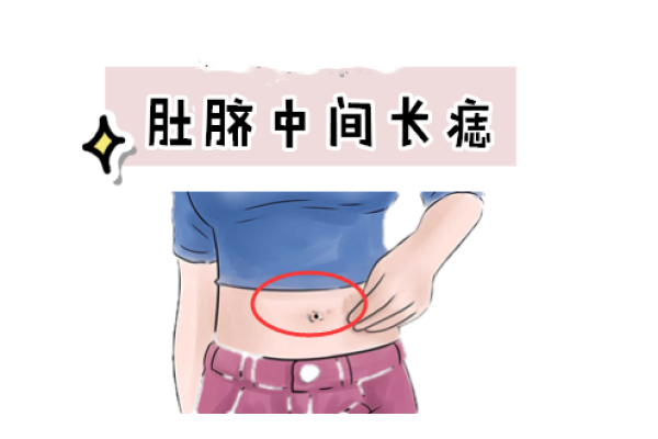 巴痣右边显，事业蒸蒸日上