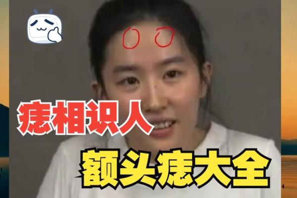 头上痣相大揭秘：看痣识人，你的痣相暗示了什么？