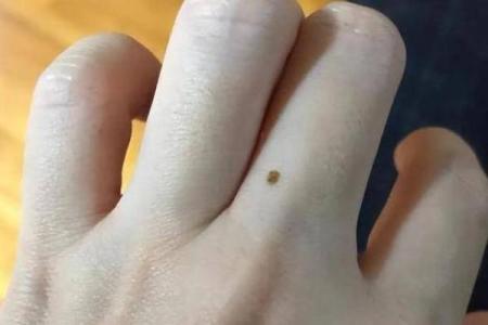 男孩身上的痣，竟然预示着这样的未来
