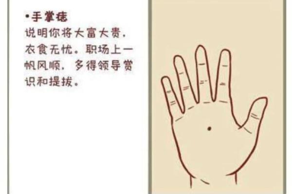 痣相算命大揭秘：手上的痣预示着什么？