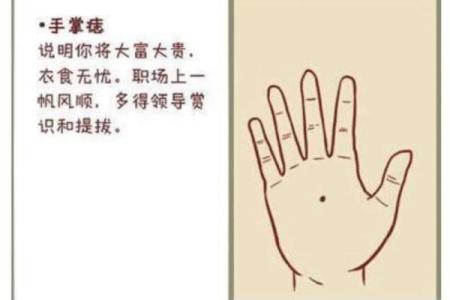 痣相算命大揭秘：手上的痣预示着什么？