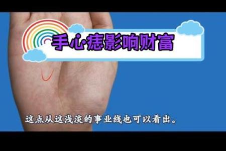 痣相中的财运宝库：看看你的发财手在哪？