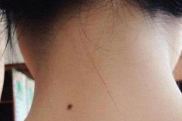 痣相美女，脖子上的秘密武器