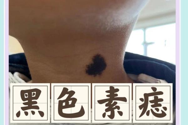 胸部痣相揭秘：男性魅力与运势的神奇密码