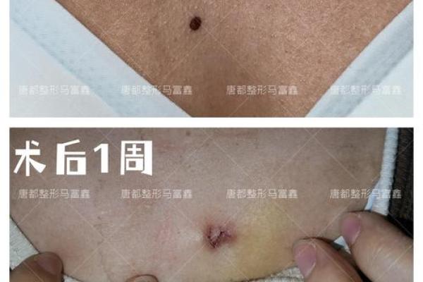 胸部痣相揭秘：男性魅力与运势的神奇密码