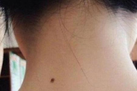 痣相美女，脖子上的秘密武器