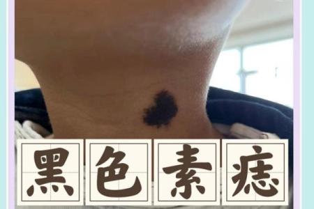 胸部痣相揭秘：男性魅力与运势的神奇密码