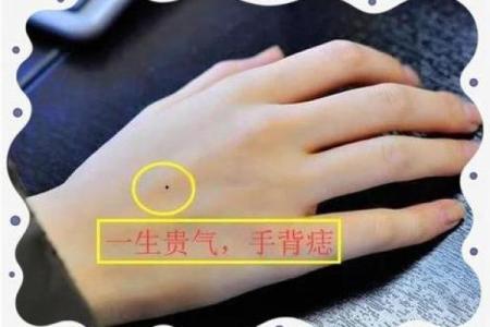 手背痣相解读：看看你的手背，运势如何？