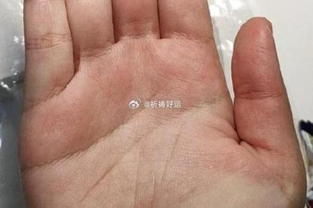 揭秘手相奥秘：手指长短透露惊人内脏健康秘密