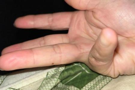 无名指上的秘密：右手痣的神奇力量