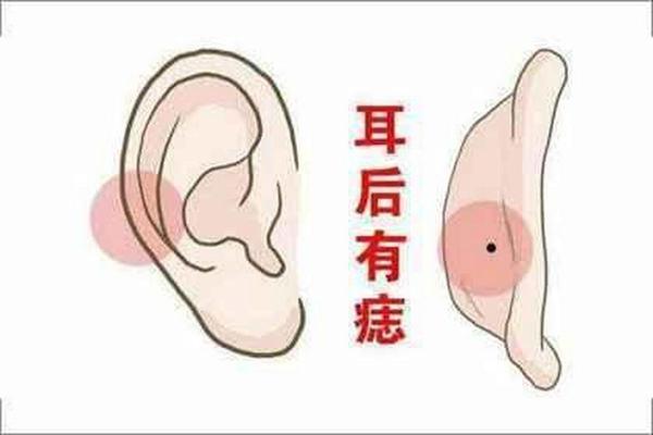 一痣解千疑，耳后脸部痣相揭秘