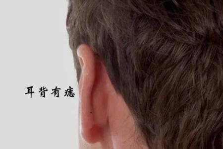 一痣解千疑，耳后脸部痣相揭秘