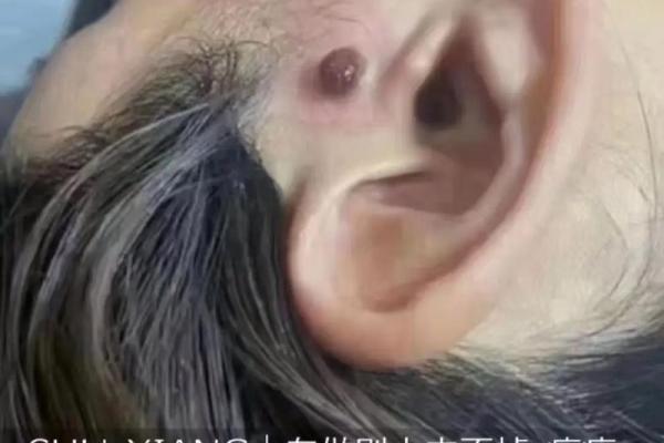 命门有痣的男人，命运多舛还是福星高照？