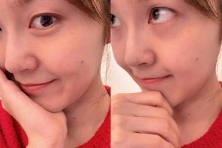 腮痣魅力：让你成为焦点的存在