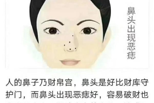 风水大师教你：痣相与人生运势的惊人关系