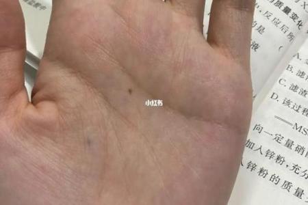 手掌痣相揭秘：右手掌痣的运势与命运