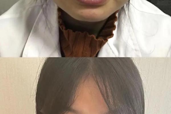 徐子淇颧骨之谜：面相高颧骨竟有这样的惊人秘密