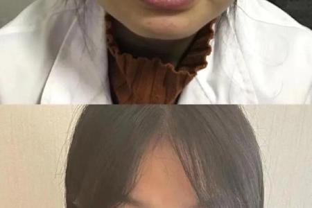 徐子淇颧骨之谜：面相高颧骨竟有这样的惊人秘密