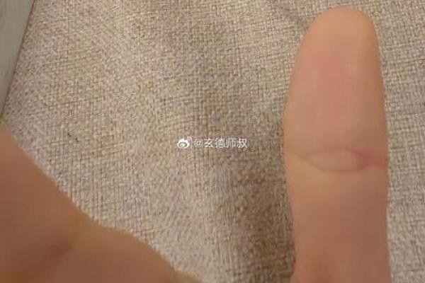 揭秘大拇指佛眼纹，手相中的吉祥之兆
