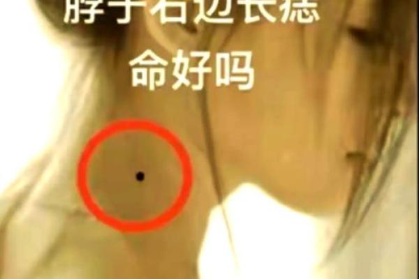 痣相大全揭秘：女性命运与美貌的密语