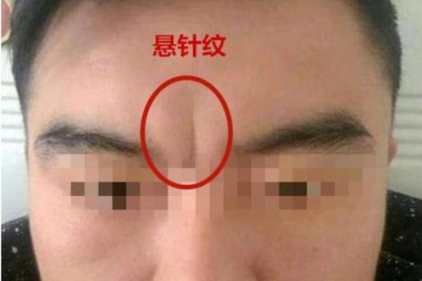 坑坑洼洼面相揭秘：揭秘命运与性格的神秘密码