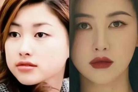 眼周痣，让你散发独特气质的秘密