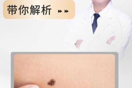 痣相解析：如何从身体印记看运势