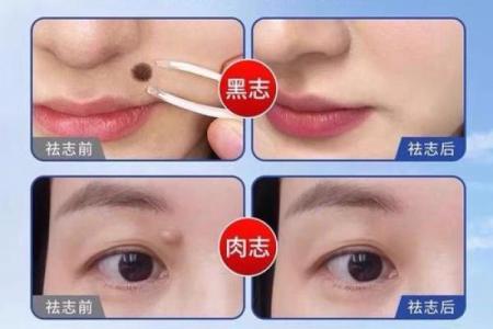 脸上痣的神奇魔力：塑造独特气质的秘密武器