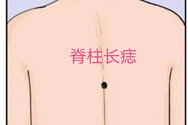 女人后背痣相解读：美丽背后隐藏的运势密码