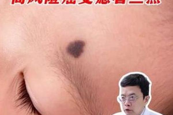奇迹降临宝宝额头痣预示着什么？