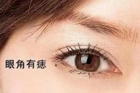 四大招财黑痣，小心财运被它们拖垮