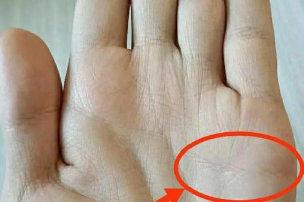 手相岛纹揭秘:多岛纹感情线,你的爱情命运如何? 手相岛纹揭秘:多岛纹感情线,你的爱情命运如何?
