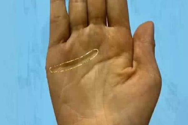 手相岛纹揭秘:多岛纹感情线,你的爱情命运如何? 手相岛纹揭秘:多岛纹感情线,你的爱情命运如何?