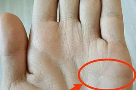 手相岛纹揭秘：多岛纹感情线，你的爱情命运如何？