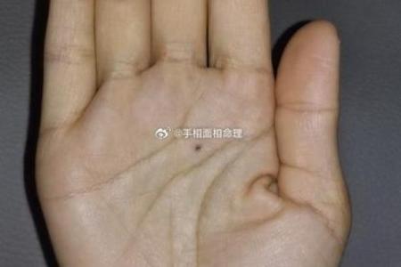 揭秘手相中木星丘有痣的秘密：运势飙升还是命途多舛？