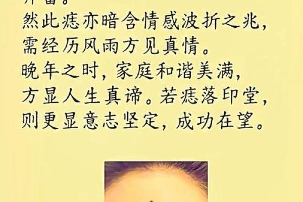 一颗痣改变命运?揭秘腮部痣相的秘密 一颗痣改变命运?揭秘腮部痣相的秘密