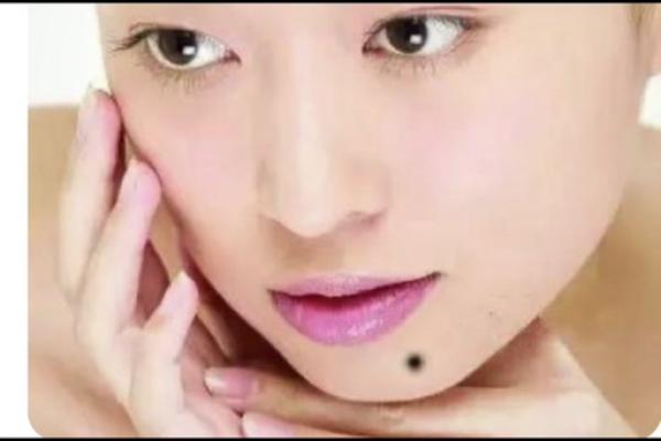 手臂上的痣,究竟暗示着什么?一篇文章告诉你 手臂上的痣,究竟暗示着什么?一篇文章告诉你